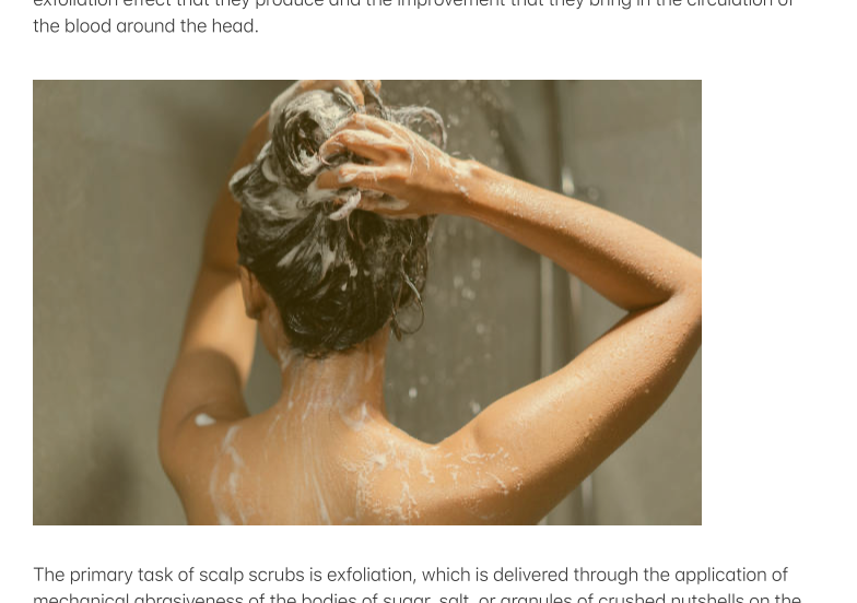 Rid of Itchy Scalp